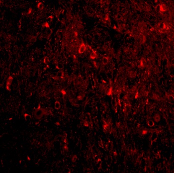 RTN4 Antibody