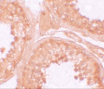 NOD6 Antibody