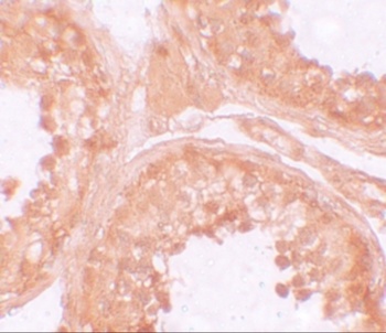 NLRP9 Antibody