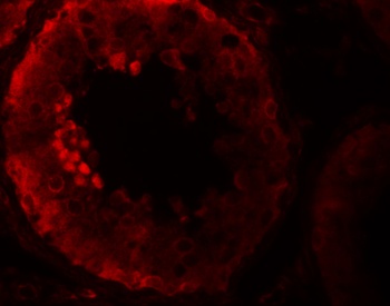 NLRP9 Antibody