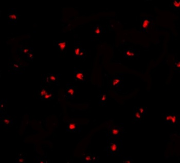 NOD2 Antibody