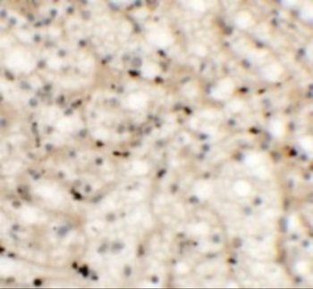 NKX2-6 Antibody