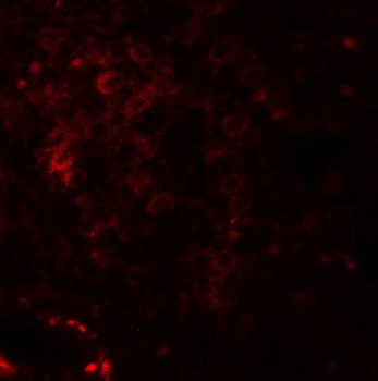 NKX2-6 Antibody