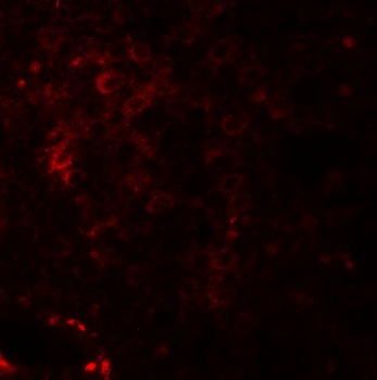 NKX2-6 Antibody