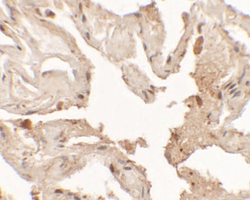 NKX2-1 Antibody