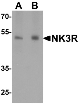 NK3R Antibody