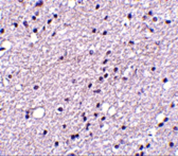 NK3R Antibody