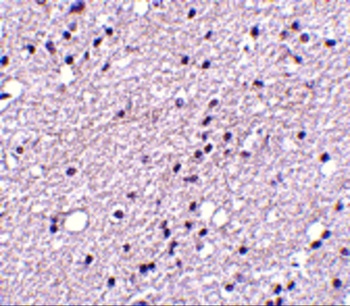 TACR3 Antibody