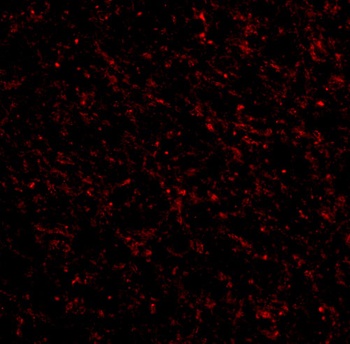 NK3R Antibody