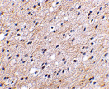 NIPSNAP1 Antibody