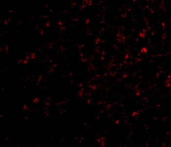 NIPSNAP Antibody