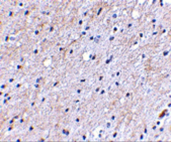NIPSNAP Antibody