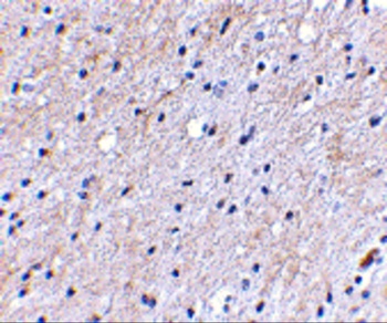 NIPSNAP1 Antibody