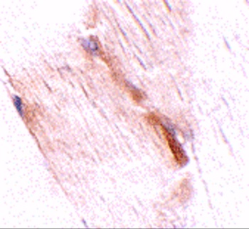 NIPSNAP2 Antibody