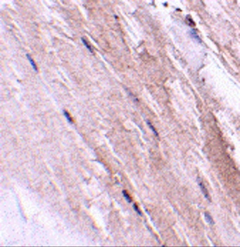 NIPSNAP2 Antibody