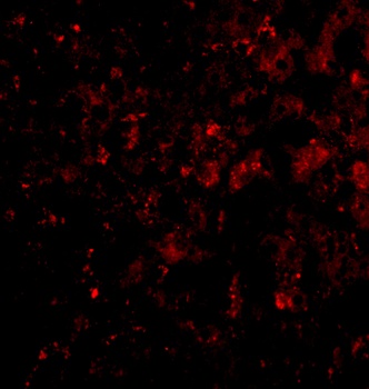 DRAM Antibody
