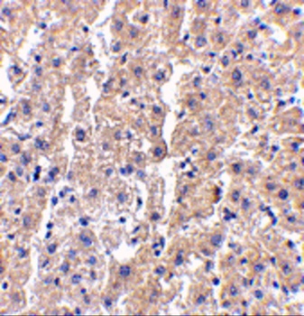 DRAM1 Antibody