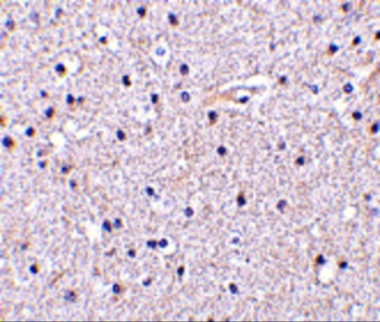 Nicastrin Antibody