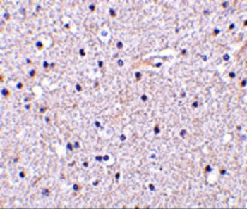 NCSTN Antibody