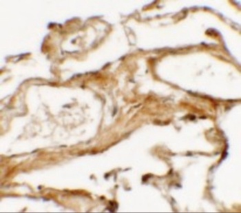 NBN Antibody