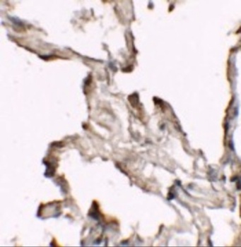 NBN Antibody