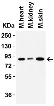 SLC9A1 Antibody