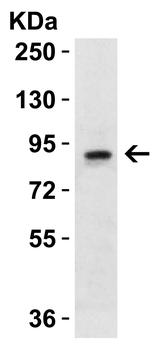 SLC9A1 Antibody