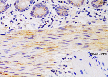 SLC9A1 Antibody