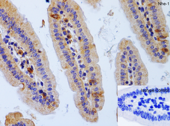 SLC9A1 Antibody