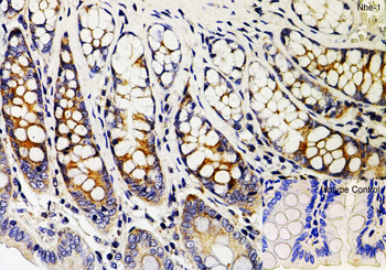 SLC9A1 Antibody