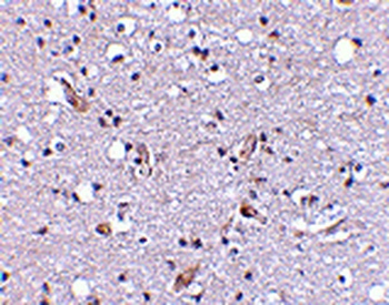 Nhe-1 Antibody