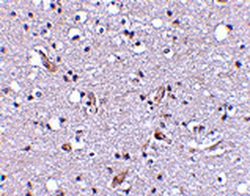 SLC9A1 Antibody