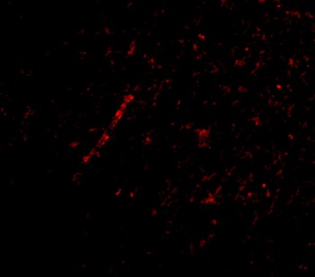 SLC9A1 Antibody