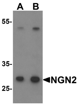 NEUROG2 Antibody