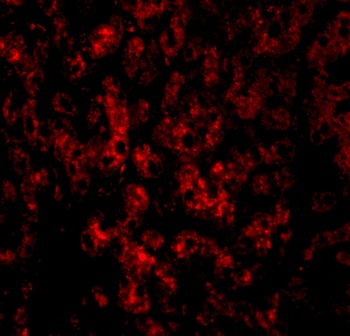 DRAM1 Antibody