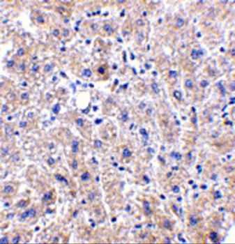 DRAM1 Antibody