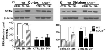 DRAM1 Antibody