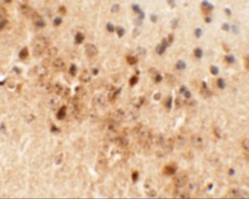 NEUCRIN Antibody