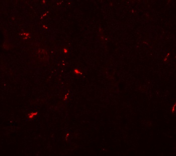 NEUCRIN Antibody