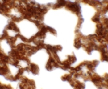 NETO1 Antibody