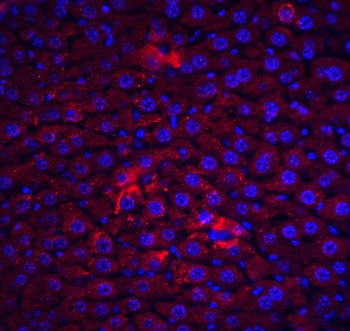 CFLAR Antibody