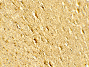 GABARAPL2 Antibody