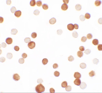 NCBP1 Antibody