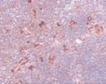 NAT11 Antibody