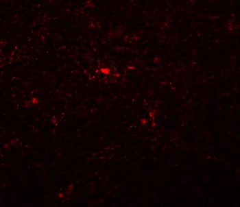 NAT11 Antibody