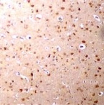 NANOS3 Antibody