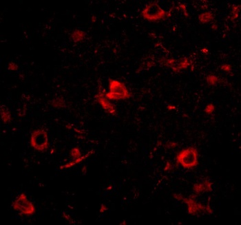 NANOS3 Antibody