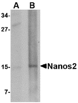 Nanos2 Antibody