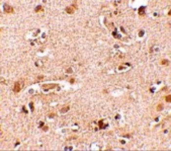 Nanos2 Antibody