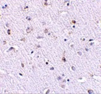 NANOS1 Antibody